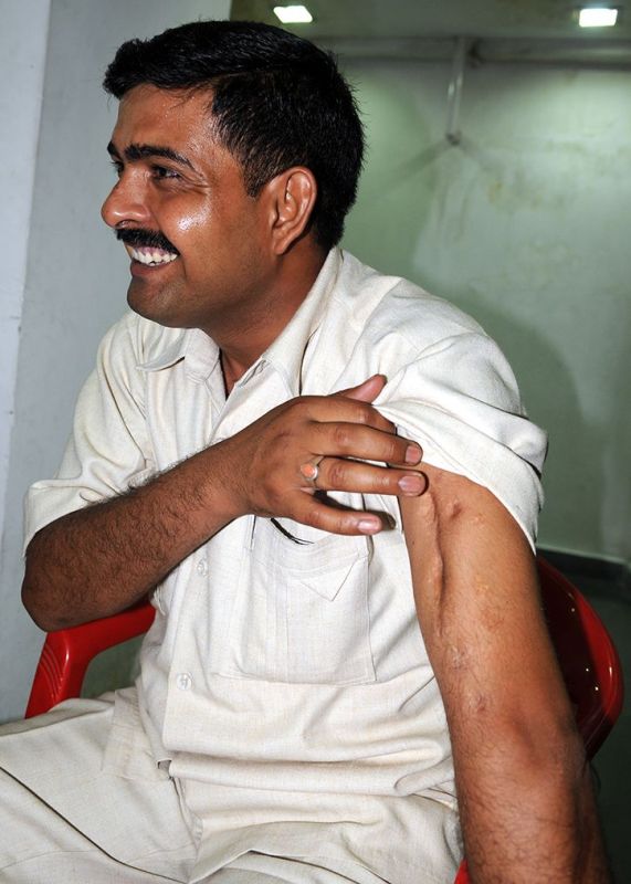 Yogendra Singh Yadav Survived Bullet Injuries