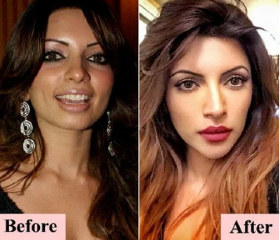 Shama Sikander Before & After Picture