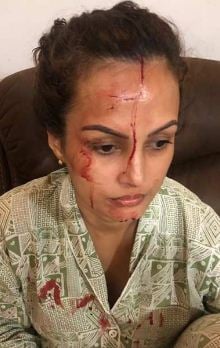 Nisha Rawal's disturbing images after the fight